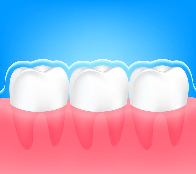 3：歯質